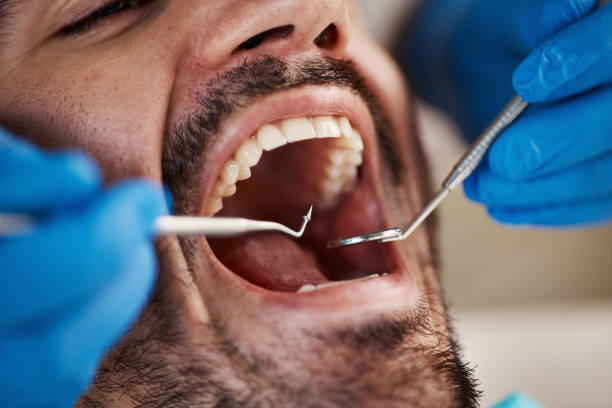 Best Same-Day Emergency Dental Services in York Harbor, ME